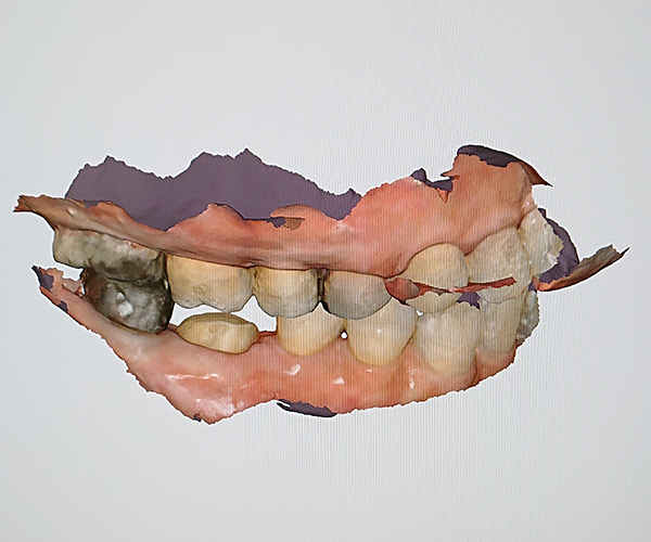 戸塚の歯医者、みずの歯科クリニックの口腔内スキャナー